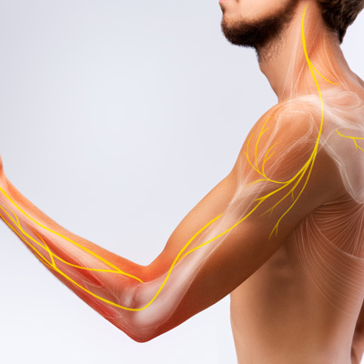 can chiropractors help with pinched nerves