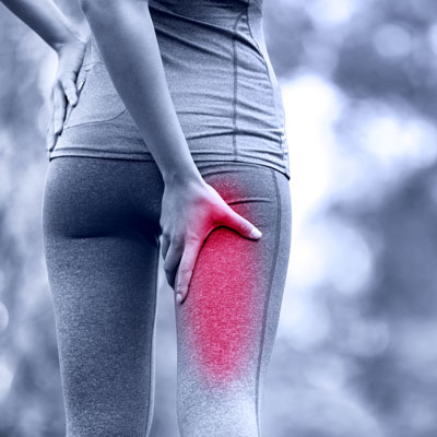 Can a Chiropractor Help with Sciatica?